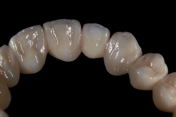 Zirconio monolitico